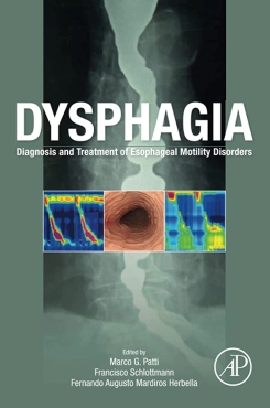Marco G. Patti  "Dysphagia Diagnosis and Treatment of Esophageal Motility Disorders" PDF